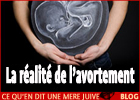 La réalité de l'avortement